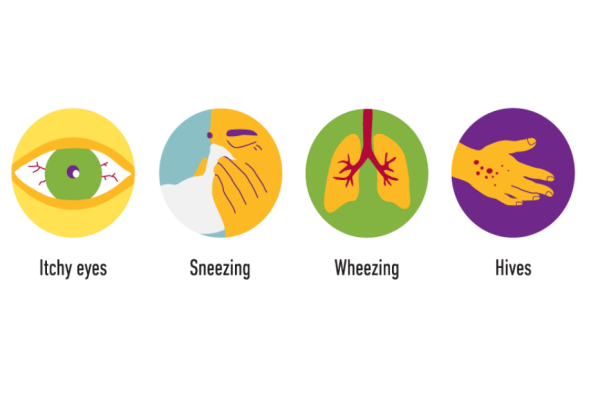 Allergy or Asthma Concerns